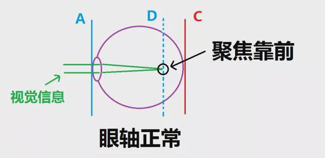 揭秘迎太阳闭眼新法！北大人民医院医生称可预防近视，真相究竟如何？